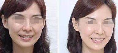 佛山哪家整形醫(yī)院超好的，超皮秒技術(shù)厲害的名單公布