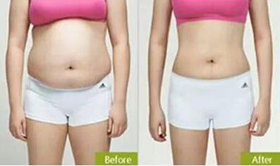 上海優(yōu)質的脂肪填充醫(yī)院哪家好？網(wǎng)友青睞排行前五強