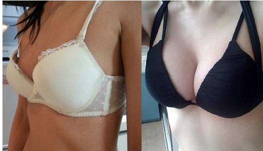 長沙雙眼皮手術(shù)：田芳斌與解燦哪位醫(yī)生更優(yōu)秀？前五專家詳細介紹！有必要留存~