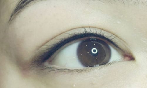 宋保強鼻部整形案例解析！西京整形醫(yī)生點評，知名醫(yī)院推薦