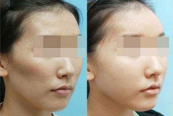 廣州曙光醫(yī)院與韓妃醫(yī)院，哪一家更值得選擇？醫(yī)療水平對比揭示醫(yī)院資質(zhì)的差異