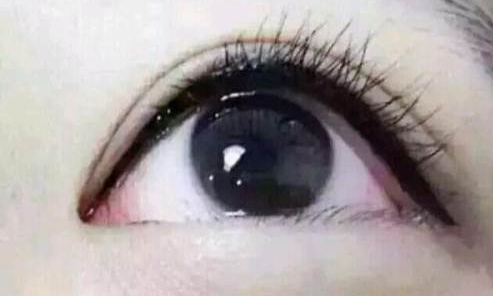 西安開眼角哪個(gè)醫(yī)院好？西安藝星整形手術(shù)優(yōu)勢(shì)及價(jià)格怎么樣？