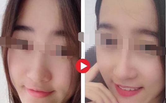 【2024年】蘇州哪家整形醫(yī)院口碑最好？評選出的前三強(qiáng)！