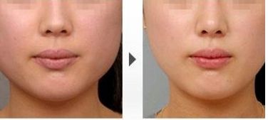 成都哪家醫(yī)院祛斑效果可靠？這兩家醫(yī)院躋身排行榜