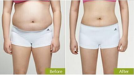 廣州雙眼皮整形醫(yī)院排名前十榜單已定！難道紫馨和軍美是口碑比較好的選擇？