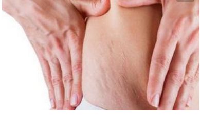 重慶亞美醫(yī)院楊武林醫(yī)生的眼部手術(shù)效果如何？