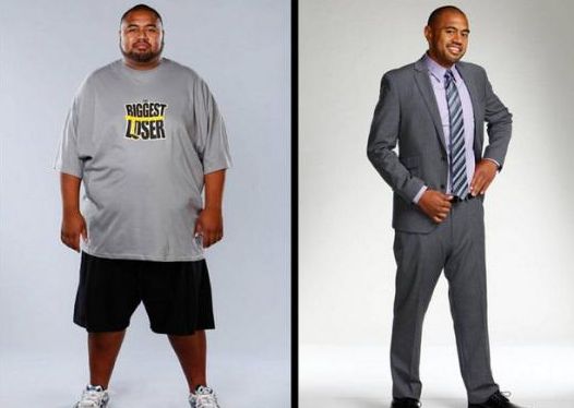 上海九院激光脫毛價(jià)格資訊，推薦專(zhuān)家選擇