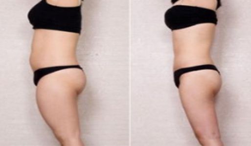 蘇州整容美容科醫(yī)院排行榜top6：鼻部整容實力醫(yī)院大揭秘！