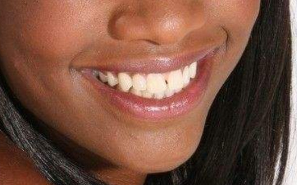 2023年河南哪家醫(yī)院手術(shù)消除動(dòng)態(tài)細(xì)紋效果更佳？全新美容醫(yī)院排行榜曝光！