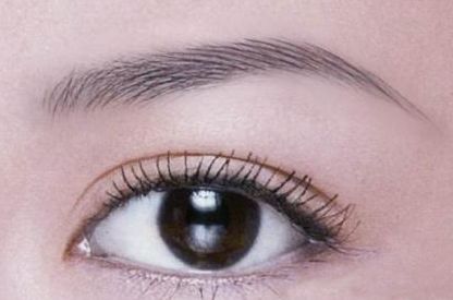 從謝峰上海第九人民醫(yī)院雙眼皮案例看手術(shù)后的自然恢復(fù)狀況