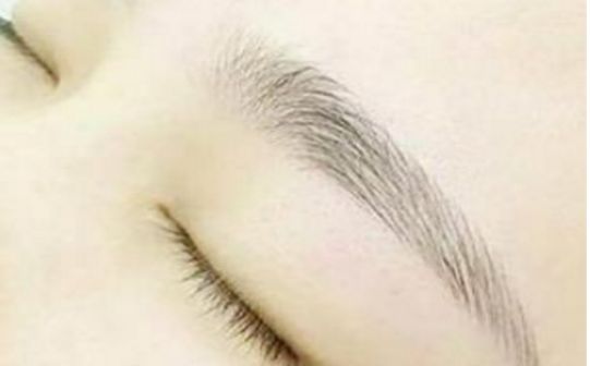 樂山市人民醫(yī)院中瞇眼袋手術(shù)談何效果？眼袋修復(fù)專家醫(yī)師及成功案例分享