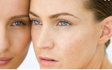 成都當(dāng)?shù)孛廊菡吾t(yī)院鼻部整形效果如何？真實(shí)案例發(fā)布！