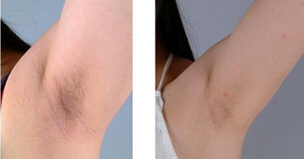 2023長春市中心醫(yī)院整形外科價格如何？【宋彬】醫(yī)生經(jīng)驗分享真可信嗎？