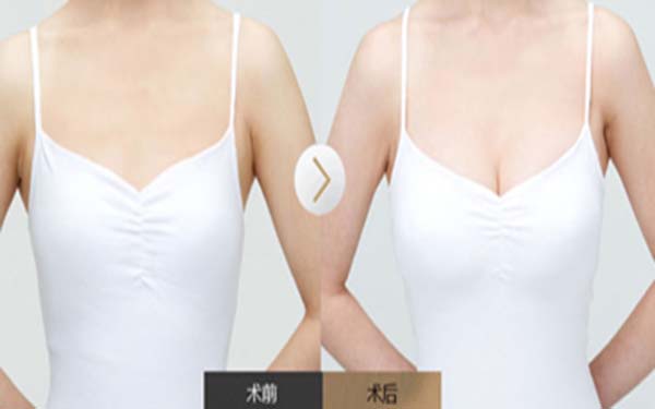 甘肅省人民醫(yī)院燒傷整形科醫(yī)生技術(shù)備受贊譽(yù)，值得信賴(lài)嗎？