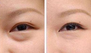 上海九院種植牙醫(yī)生推薦：這幾位牙醫(yī)技術(shù)獨(dú)特，深受患者好評(píng)！