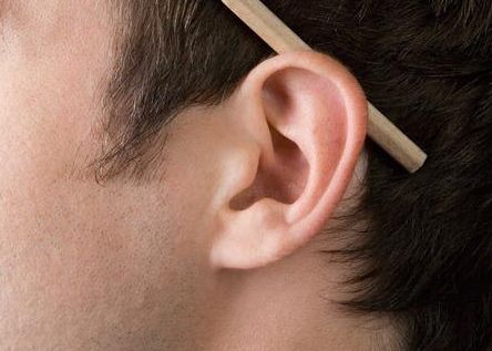 轉(zhuǎn)變?yōu)椋簭堄喙庵臼覐臀皇中g技巧如何？醫(yī)師評述和實際手術恢復圖解！