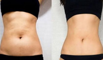 西安有哪些技術(shù)高超的雙眼皮修復(fù)醫(yī)生值得選擇？