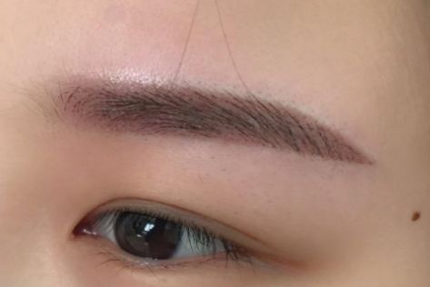 重慶時光整形美容醫(yī)院高手醫(yī)生幫你輕松遠離斑點困擾