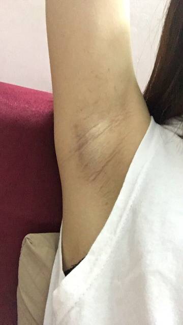 上海健橋植發(fā)技術(shù)實力如何？頭發(fā)再生效果值得期待嗎？