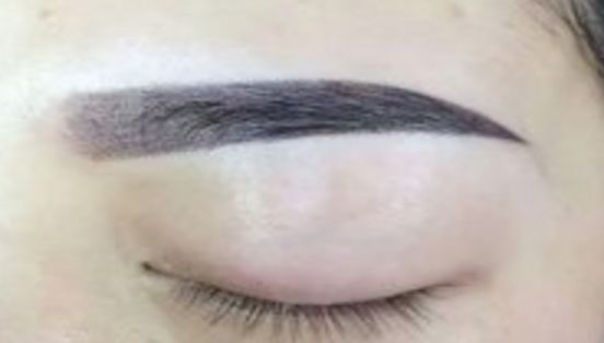 大連微整形醫(yī)院，注重玻尿酸填充技術(shù)優(yōu)勢