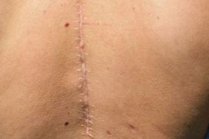 廣州龍城區(qū)手術(shù)神醫(yī)排行榜，醫(yī)術(shù)高超的拉皮專家一覽