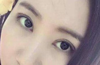 上海華東醫(yī)院整形外科主任醫(yī)師榜單揭曉！先進隆鼻療法案例分享及費用明細，急需閱讀！