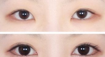 廣州韓后許滿(mǎn)萍醫(yī)生的專(zhuān)業(yè)領(lǐng)域揭秘，令人驚喜的嫩膚案例分享