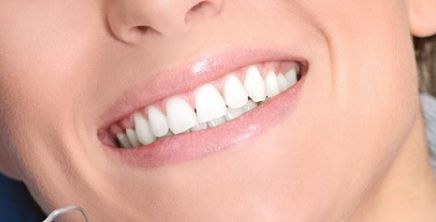 西京醫(yī)院鼻部整形丨馬顯杰教授，項目介紹與真人案例圖解析