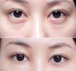 上海美萊醫(yī)院的療效一流，備受好評的醫(yī)生大揭秘！