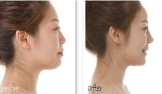 廣州植發(fā)全新醫(yī)院排行榜，權(quán)威榜單公布，趕緊收藏！