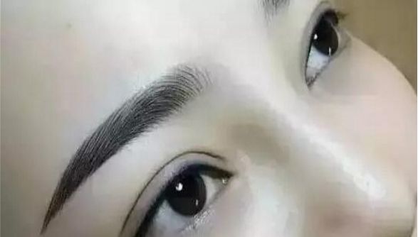 重慶曹陽(yáng)的鼻子整形效果如何？醫(yī)生手藝獨(dú)步天下的真實(shí)案例分享