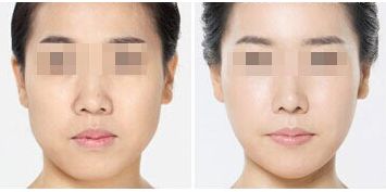 深圳整形美容醫(yī)院排名前十，哪家更受用戶好評？