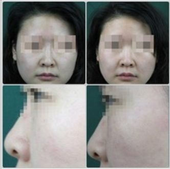 長沙哪家整形醫(yī)院排名靠前，技術(shù)專業(yè)受用戶好評