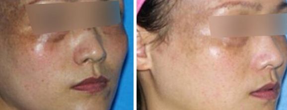 蘭州固定輪廓挑選攻略，幫你找到最佳選擇！