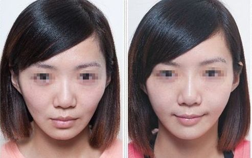 大連大學(xué)附屬新華醫(yī)院整形外科：2023年度公開回顧