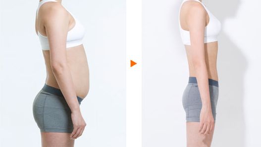 陳振宇的雙眼皮手術效果如何？在青醫(yī)附院的真實案例鑒賞提供參考