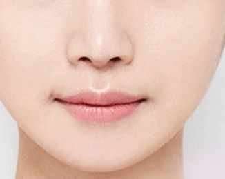 空軍總醫(yī)院眼袋手術(shù)費(fèi)用及技術(shù)解析，醫(yī)師解讀+成功案例分享