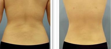 2023年溫州地區(qū)出現(xiàn)多位肋骨鼻醫(yī)生上榜！