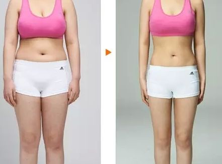 貴陽市雙眼皮整形醫(yī)院推薦！四家專業(yè)醫(yī)院綜合對比