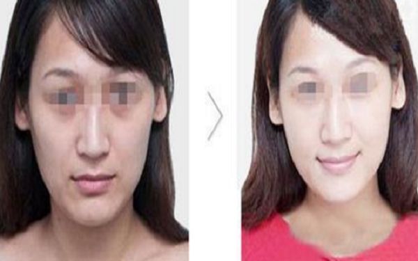 昆明鼻部整形醫(yī)院綜合評(píng)價(jià)排行榜