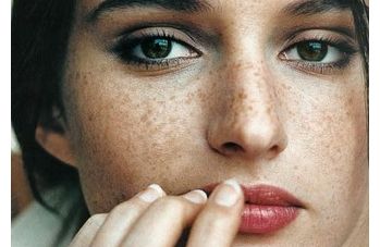 上海九院姜陶然醫(yī)生給您帶來玻尿酸面部煥新！2023案例公開揭秘