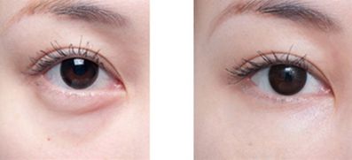 沈陽整形醫(yī)院精心挑選，排名領(lǐng)先醫(yī)院揭曉