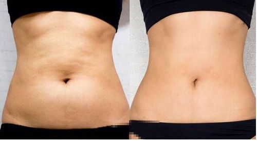 上海葉麗萍醫(yī)生進行鼻部整形效果如何？最新成功案例曝光