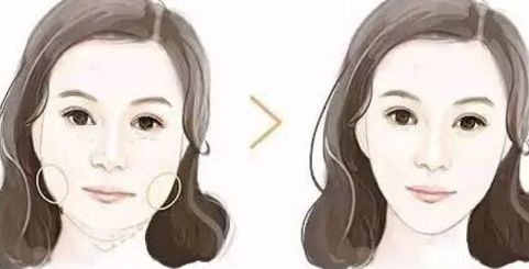 廣州拉皮手術(shù)哪里做效果好？華美、曙光等知名醫(yī)院上榜！