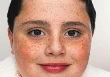 武漢協(xié)和醫(yī)院整形外科引領23年隆胸事例放映