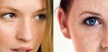 黃久佐醫(yī)生為你分享雙眼皮效果及技術測評！