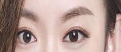 貴陽美貝爾徐威鼻子整形效果如何？90天親身經(jīng)歷曝光案例揭秘