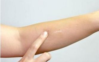 上海脂肪抽吸醫(yī)生技術(shù)大比拼，排行前十新榜單揭曉