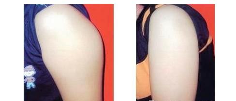 上海九院的整形價(jià)格表是怎樣的？它適合想要變美的人嗎？