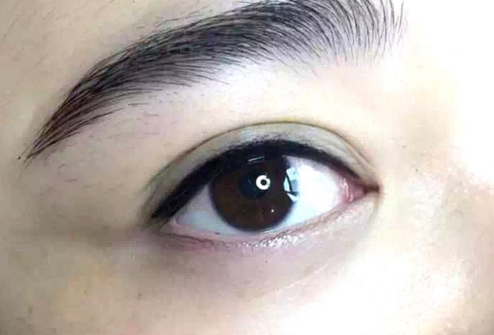 福州愛美爾醫(yī)療美容醫(yī)院是否可信？福州愛美爾醫(yī)療美容醫(yī)院的手術(shù)價格如何？